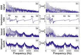 Voice Acoustics An Introduction To The Science Of Speech
