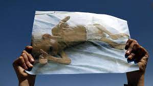 Dem bürgerkriegsland jemen droht nach angaben der uno die weltweit schlimmste hungersnot seit jahrzehnten. Die Katastrophe Im Jemen Un Warnen Vor Dramatischer Hungersnot N Tv De