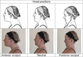 預防頸椎病 肩周炎 每日 吊脖子5分鐘 放鬆肩頸渾身不再酸痛 爆新聞 chin tuck thoracic cervical