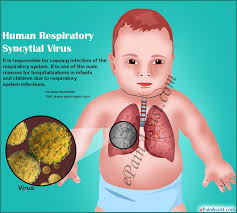 Epidemiology and prevention of respiratory syncytial virus infections among infants and young children. Human Respiratory Syncytial Virus Treatment Prevention Symptoms