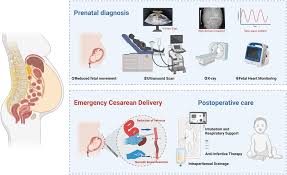 Image result for Intestinal Malrotation