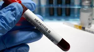 Hepatitis B Ansteckung Folgen Vorbeugung Gesund Bund De