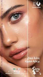 ربيعك بشرة كلها نضارة #بريدة