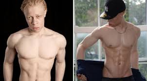 We did not find results for: Pria Negro Albino Ini Sukses Jadi Model Ternama Poker Domino Kiu Kiu Online Bundapoker