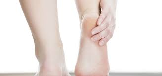 Tumit kaki merekah boleh menyebabkan kita rasa tidak selesa bila berjalan. Ketahui Punca Tumit Kaki Pecah Dan Merekah