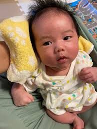 赤ちゃん 頭皮 臭い