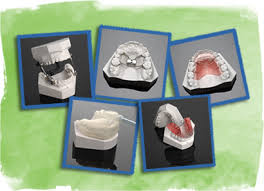 Northstar Orthodontic Laboratory Your Complete Orthodontic