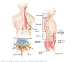 The pain from pancreatitis may start in your upper abdomen and radiate to your lower back. Vertebral Tumor Symptoms And Causes Mayo Clinic