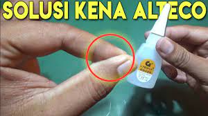 Cara ini me hilangkan lem ini sering bahkan selalu saya pake ketika kulit tangan saya terkena lem g dan sejenisnya. Cara Melepaskan Kulit Jari Kena Alteco Lem G Super Glue Youtube