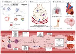 Maybe you would like to learn more about one of these? Coronavirus Disease 2019 Associated Thrombosis And Coagulopathy Review Of The Pathophysiological Characteristics And Implications For Antithrombotic Management Journal Of The American Heart Association
