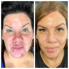 🌟🌯 Client Review: ANAT