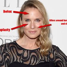 Despite showing up at an award ceremony looking radically different, zellweger swears up and down that she has not received any sort of plastic . Renee Zellweger S Changing Face Actress Has Fillers Botox And Eye Bag Removal According To Leading Plastic Surgeon Mirror Online