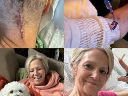 Fundraiser for Michael Mitchell by Mary Mitchell : Support Bonnie's  Recovery After Brain Surgery