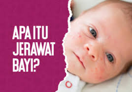 Apa stands for the american psychological association, which is an organization that focuses on psychology. Hfmd 1 Fakta Tentang Penyakit Tangan Kaki Dan Mulut Youbaby