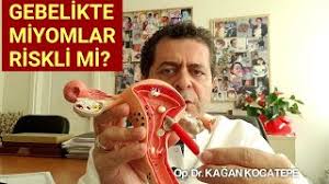 dusuk abortus ve tekrarlayan dusukler
