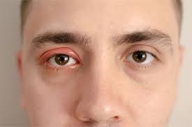 Image result for Blepharis bainesii