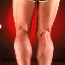 Pin On Knee Pain
