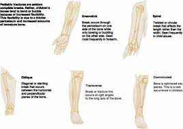 Hesi Case Studies Subcutaneous Tissue Simple Fracture Types Of Fractures