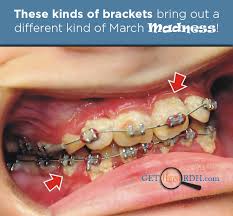 Get Hired Rdh Dental Orthodontics Dental Braces