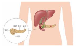 臺大醫院雲林分院虎尾院區 腫瘤醫學部 陳若白 june 27 , 2015 胰臟解剖位置 胰臟癌前病變演進史 è¨ºæ–·å¥ªå'½ç™ŒçŽ‹èƒ°è‡Ÿç™Œ é«˜éšŽå½±åƒæª¢æŸ¥çš„é‡è¦æ€§ æ°¸è¶Šå¥åº·ç®¡ç†ä¸­å¿ƒ