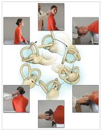 Image result for Canalith Repositioning Procedure