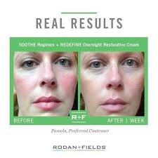 Moisturizer with SPF for minimizing redness?