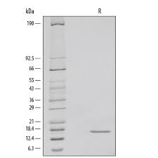 Recombinant Human Ifn Gamma Protein 285 If 100 R D Systems