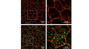 Loss of “Youth” Protein May Drive Aging in the Eye