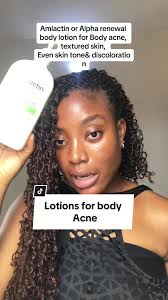 Kebaikan Renew Intensive Skin Therapy Lotion