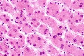 Image result for Perfluorohexyloctane