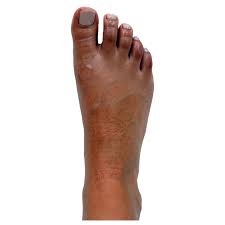 The feet are divided into three. Foot And Ankle Orthopaedic Surgeons Find An Orthopaedic Surgeon Near You