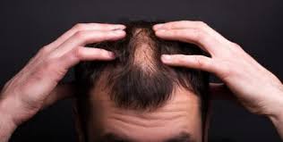 While everyone dreams of long. 8 Easy Ways To Increase Hair Density Doclists