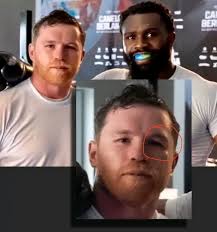 Boxer ignores training for fan pictures