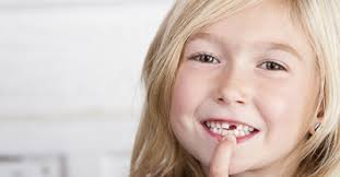 Here are some simple and effective ways to pull a loose tooth. Fun Ways To Pull A Loose Tooth Chesheim Dental Associates