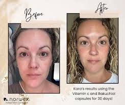 Get free viral skin serum with purchase