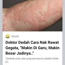 Cara menghilangkan cegukan dengan es batu sangat mudah yaitu dengan mengusapkan bongkahan es batu ke dagu dan juga meminum menghilangkan cegukan juga bisa menggunakan selai kacang. Ingat Tak Uzayr Dan Amira Kak Siti Founder Csiti Aromatherapy Facebook