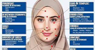 Punca Jerawat Di Muka Dan Langkah Untuk Hilangkan Jerawat Umi Nazrah