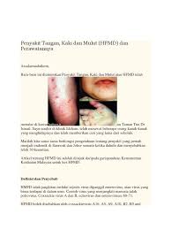 Tetapi penyakit ini boleh dikawal daripada menular dengan penjagaan kebersihan yang betul. Penyakit Tangan