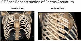 Image result for Cathormion