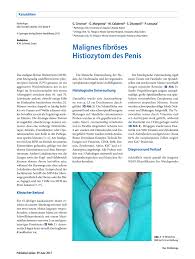 Leiomyosarcoma Of The Penis He X100 Download Scientific Diagram