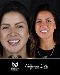 HOLLYWOOD SMILES (@hollywoodsmilescol) · Santiago de Cali