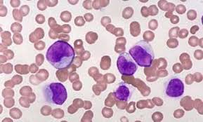 Znalezione obrazy dla zapytania leukosit