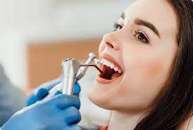 Teeth Cleanings in Mississauga, ON | Dental Checkup and Cleaning