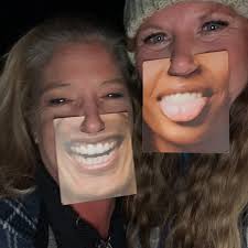 Good news, out of 14 worrisome spots…only 1 required intervention this  time. Of course it was my face, but I will take that over the M word they  were throwing around for