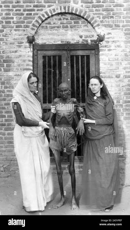 Photographic print of an emaciated famine victim standing in between Miss Neil and an unidentified woman. Dated 1910 Stock Photo - Alamy