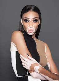the shamayim photographer shamayim http shamayimstudios com instagram shamayim winnie harlow winnie model vitiligo model