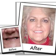 CENTRAL TEXAS IMPLANT CENTER