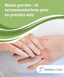 Mains Gercees Comment En Prendre Soin Ameliore Ta Sante Prendre Soin De Soi Soins Des Mains Mains