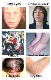 Pin On Thyroid Problems And Diet