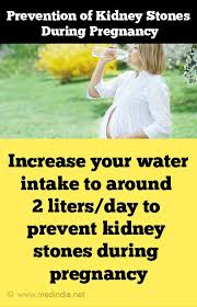 Kidney Stones During Pregnancy
